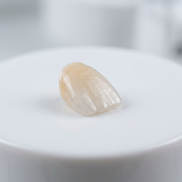 Ceramic Restorations