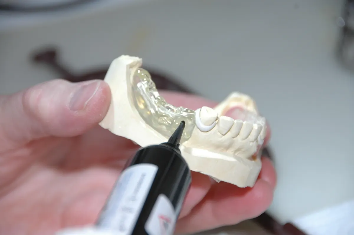 Dental technician finishing a custom removable prosthetic on a dental model in Trinidad